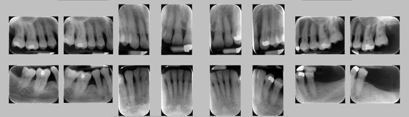 Protocollo parodontale 1