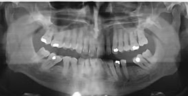 Protocollo parodontale 2